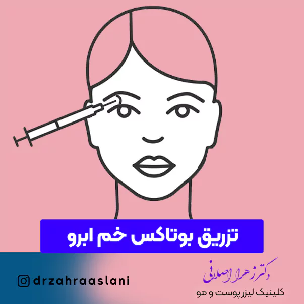110-Botox injections to bend the eyebrows-تزریق بوتاکس خم ابرو در اصفهان با قیمت مناسب در بهترین کلینیک دکتر زهرا اصلانی پوست