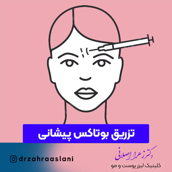 110-Forehead botox injection-تزریق بوتاکس پیشنانی در اصفهان با قیمت مناسب در بهترین کلینیک دکتر زهرا اصلانی پوست