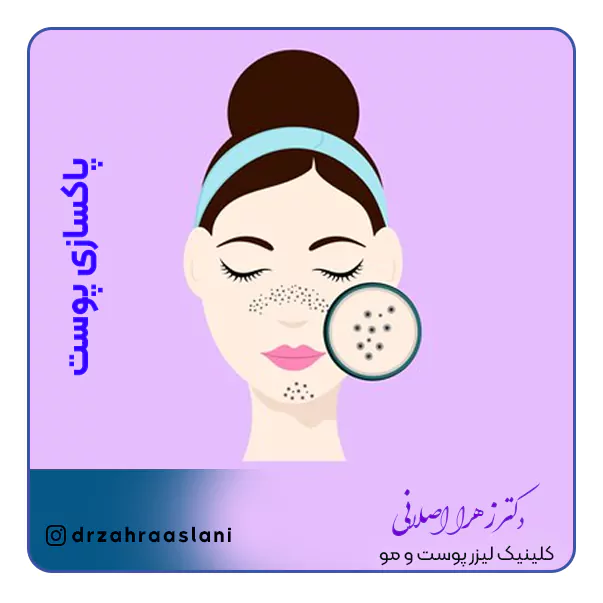 112-skin-cleaning-مرکز پاکسازی پوست در منزل با بهترین دکتر پوست اصفهان