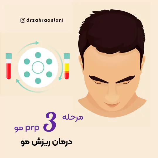 117-3-hair-prp-مرکز prp-بهترین مراکز پی آر پی مو در اصفهان در بهترین کلینیک درمان ریزش موی اصفهان